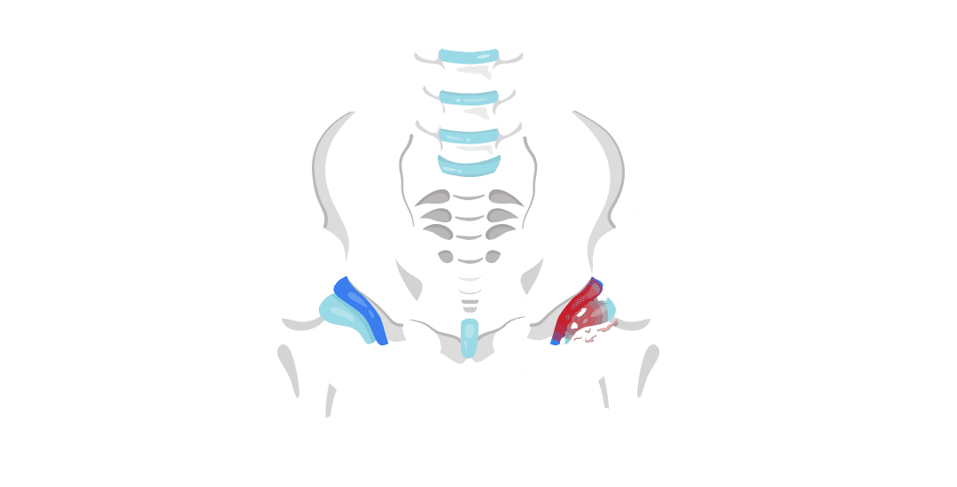 Кульшовий суглоб